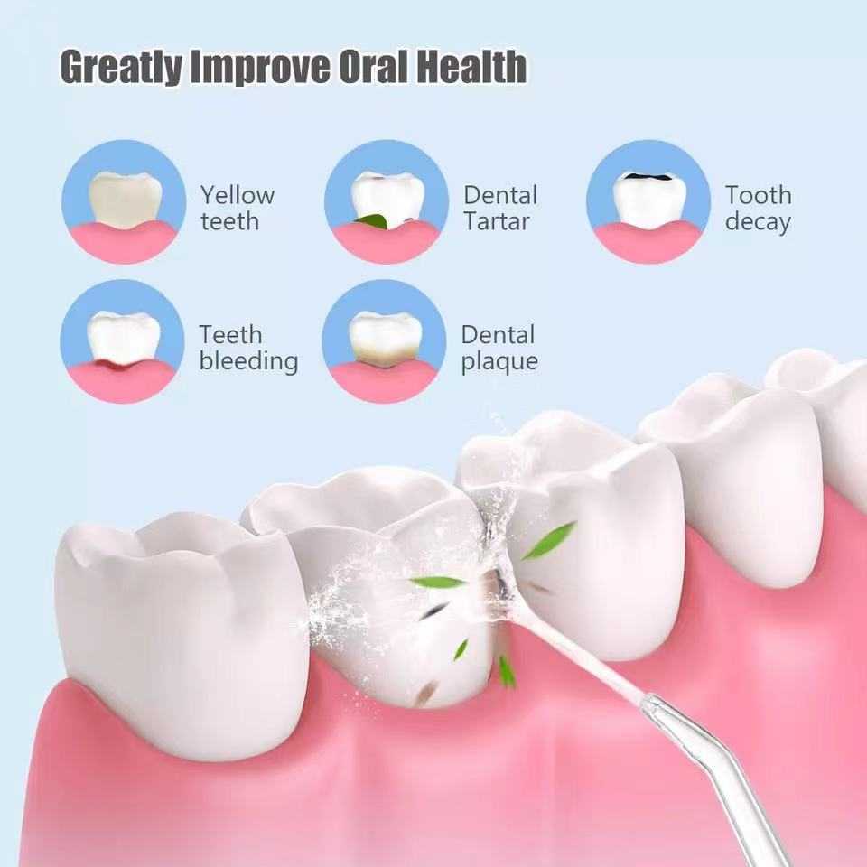 Waterproof Irrigator Dental CleanerExpress Global Mart  Introducing the Pen Brush Cleaning Tool - Your Ultimate Dental Companion!
✨ Powerful Oral Care: Say goodbye to plaque and hello to sparkling teeth! Our oral irrigatoWaterproof Irrigator Dental CleanerZendrop