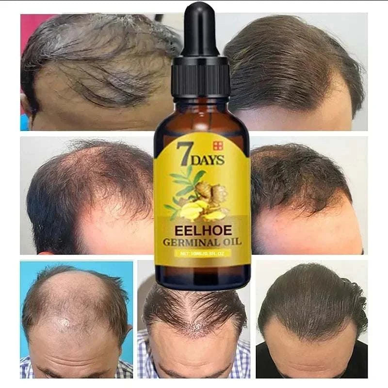 Fast Hair Growth OilExpress Global Mart  Unlock the Secret to Luxurious Locks with Our Fast Hair Growth Oil
Transform your hair from dull and lifeless to thick and shiny with our Fast Hair Growth Oil. FormuFast Hair Growth OilDSers