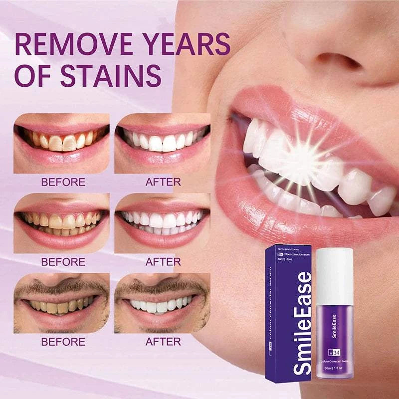 Purple Whitening ToothpasteExpress Global Mart  ✨🦷 Transform Your Smile with Purple Whitening Toothpaste! 🦷✨
Achieve a dazzling, white smile with our revolutionary Purple Whitening Toothpaste. Specially formulatPurple Whitening ToothpasteDSers