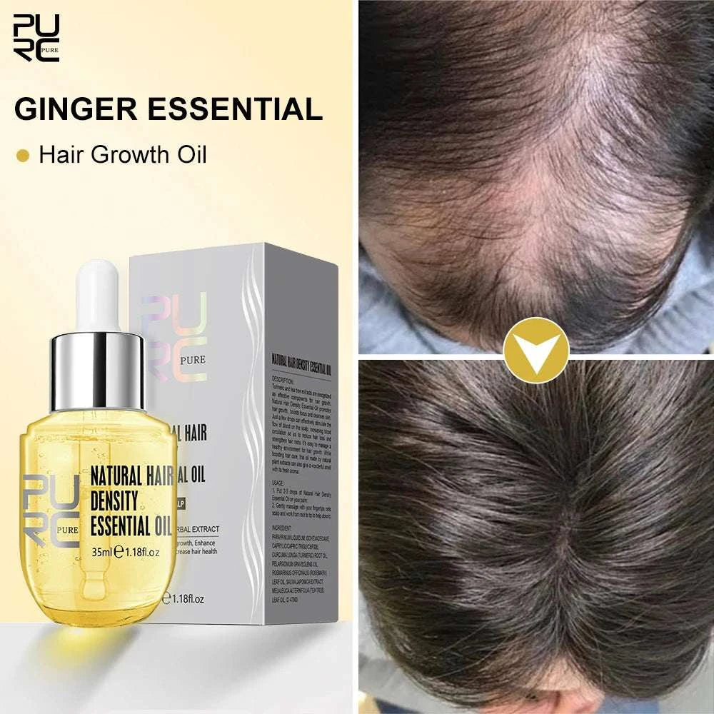 Hair Growth OilExpress Global Mart  🌿✨ Transform Your Hair with Natural Ginger Hair Growth Oil! ✨🌿
Unlock the secret to luscious, thick, and healthy hair with our Natural Ginger Hair Growth Oil. PerfHair Growth OilDSers