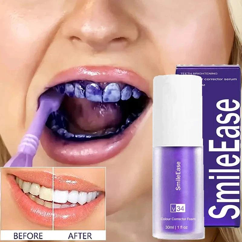 Purple Whitening ToothpasteExpress Global Mart  ✨🦷 Transform Your Smile with Purple Whitening Toothpaste! 🦷✨
Achieve a dazzling, white smile with our revolutionary Purple Whitening Toothpaste. Specially formulatPurple Whitening ToothpasteDSers